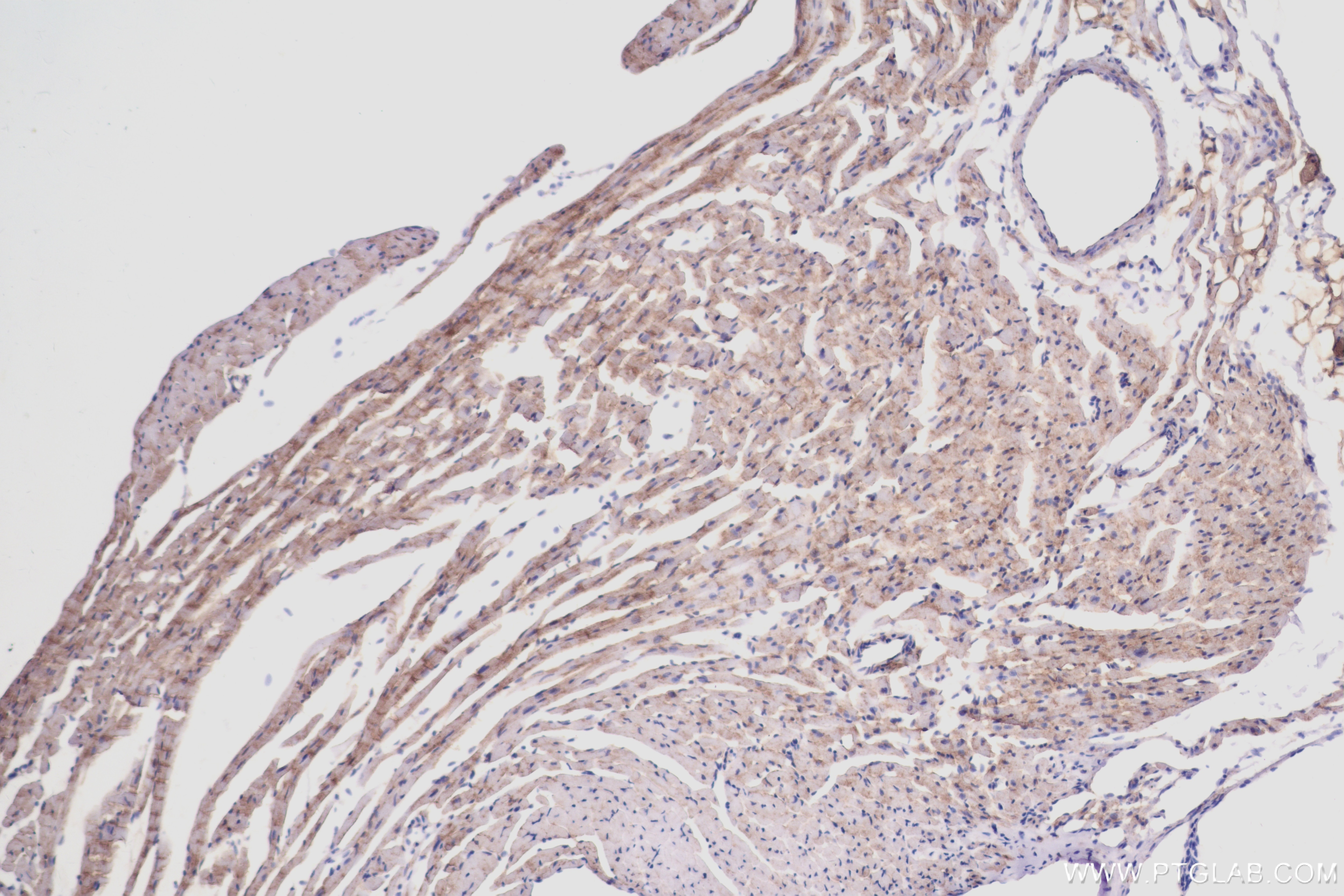 Immunohistochemistry (IHC) staining of mouse heart tissue using Myosin 2a Recombinant antibody (84099-1-RR)