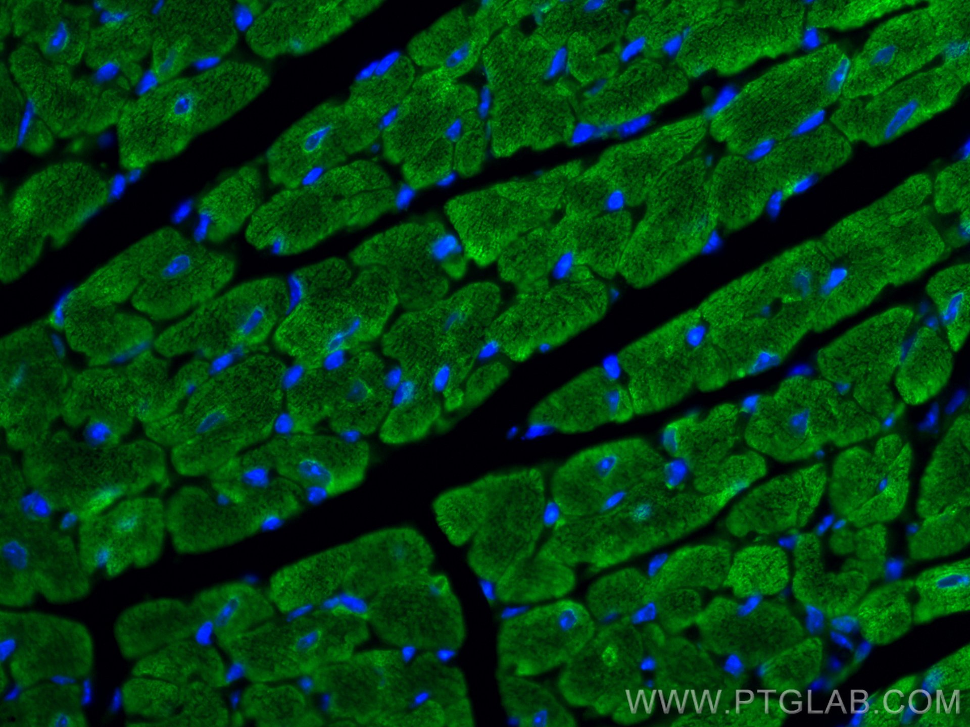 Immunofluorescence (IF) / fluorescent staining of mouse heart tissue using CoraLite® Plus 488-conjugated Myosin Light Chain 2 (CL488-10906)