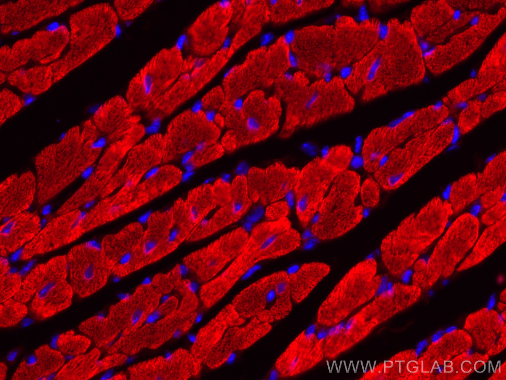 Immunofluorescence (IF) / fluorescent staining of mouse heart tissue using CoraLite®594-conjugated Myosin Light Chain 2/MLC-2 (CL594-10906)