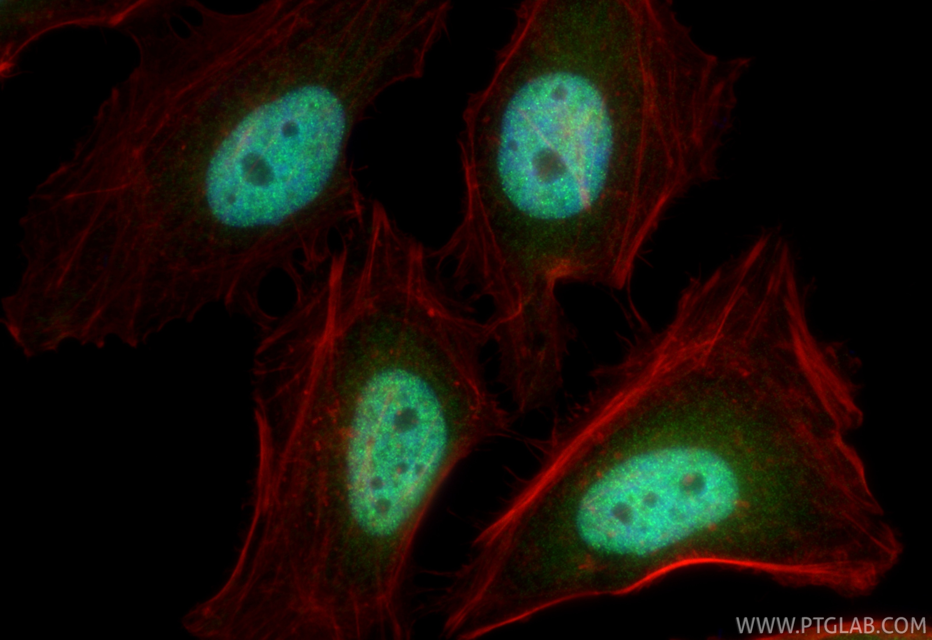 IF Staining of HeLa using 14833-1-AP Immunofluorescence (IF) / fluorescent staining of HeLa cells using GLYR1 Polyclonal antibody (14833-1-AP)