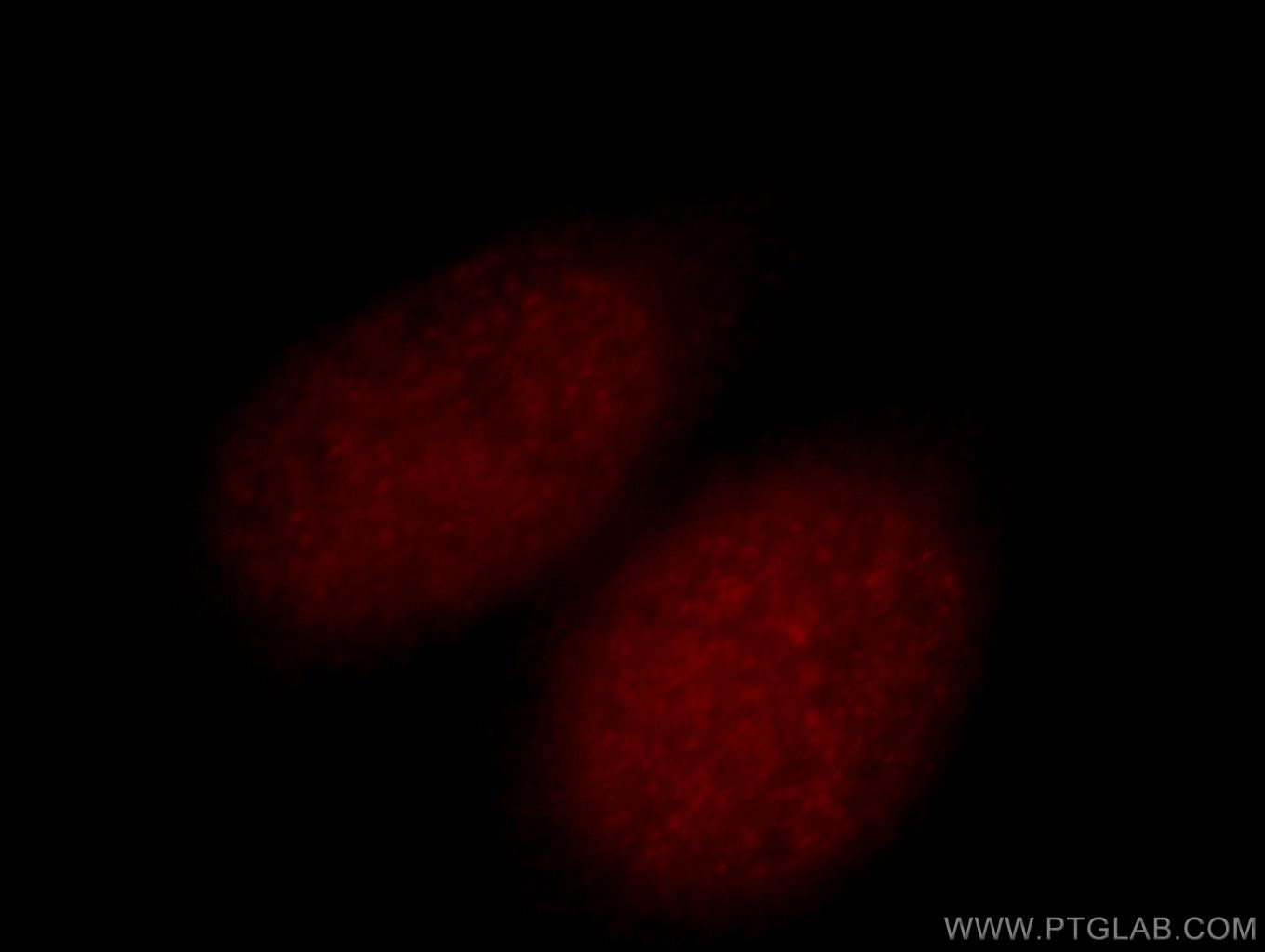 Immunofluorescence (IF) / fluorescent staining of HeLa cells using GLYR1 Polyclonal antibody (14833-1-AP)