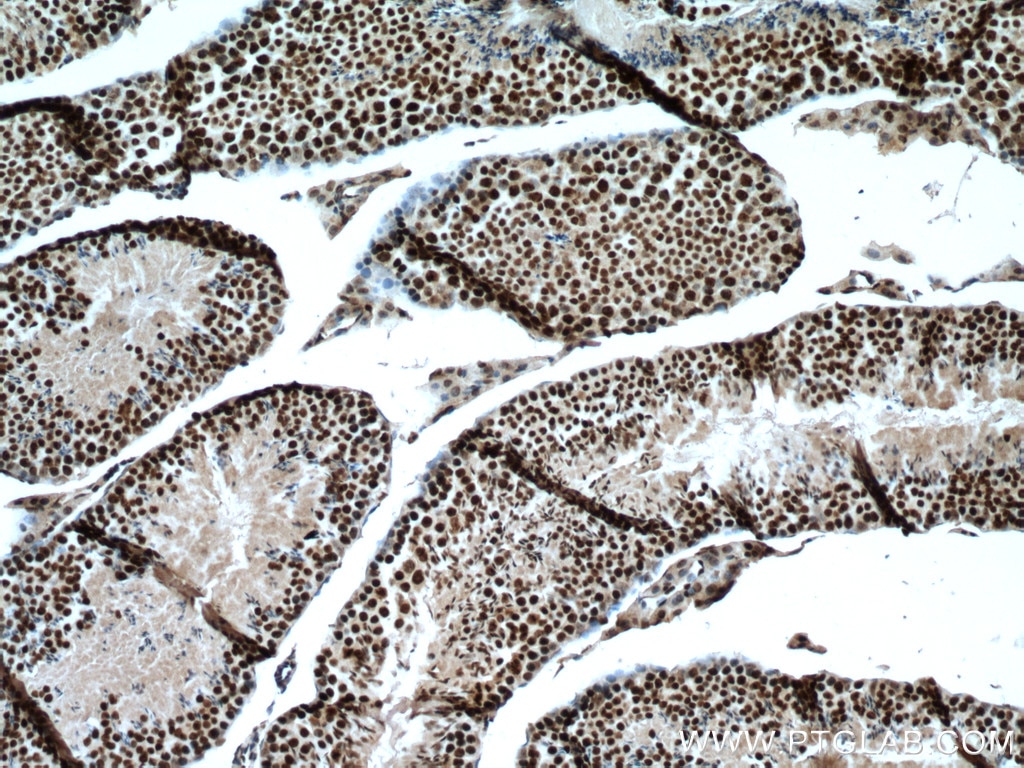 Immunohistochemistry (IHC) staining of mouse testis tissue using GLYR1 Polyclonal antibody (14833-1-AP)