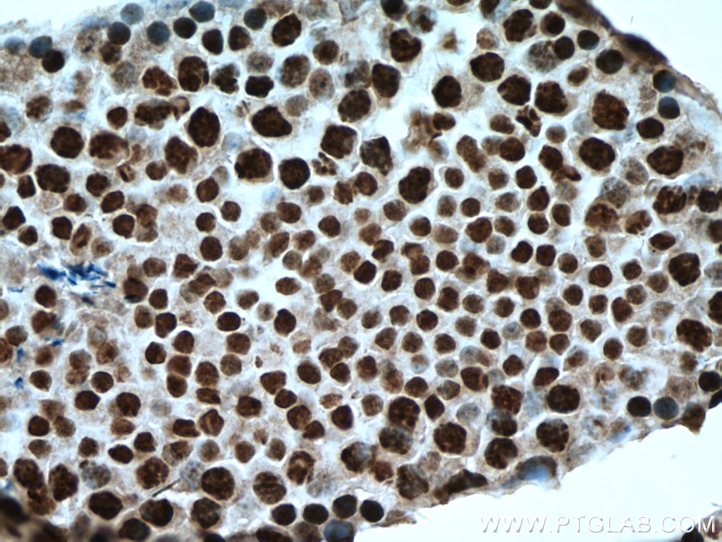 Immunohistochemistry (IHC) staining of mouse testis tissue using GLYR1 Polyclonal antibody (14833-1-AP)
