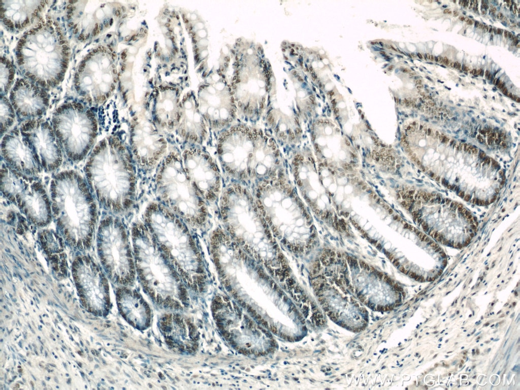 Immunohistochemistry (IHC) staining of human colon tissue using GLYR1 Polyclonal antibody (14833-1-AP)