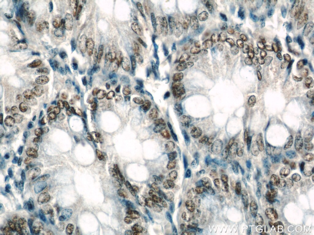 Immunohistochemistry (IHC) staining of human colon tissue using GLYR1 Polyclonal antibody (14833-1-AP)