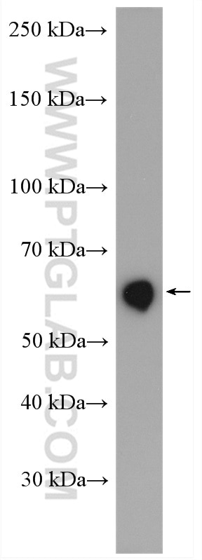 Western Blot (WB) analysis of HL-60 cells using GLYR1 Polyclonal antibody (14833-1-AP)