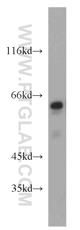 Western Blot (WB) analysis of HeLa cells using GLYR1 Polyclonal antibody (14833-1-AP)
