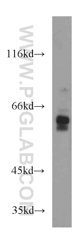 Western Blot (WB) analysis of Jurkat cells using GLYR1 Polyclonal antibody (14833-1-AP)