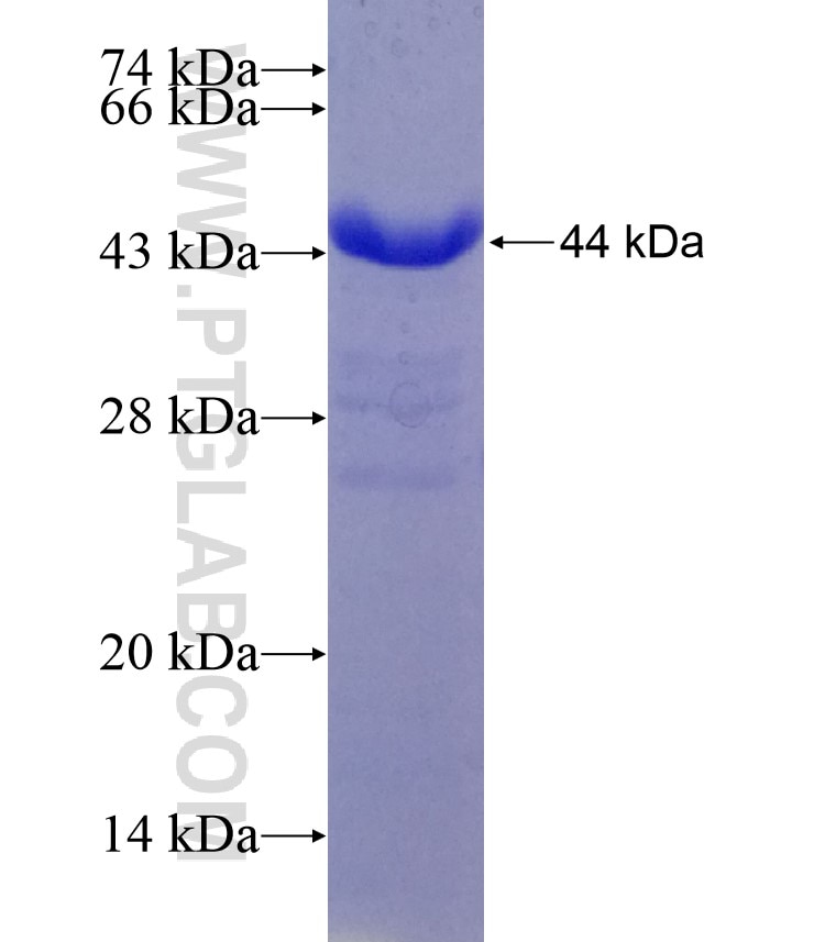 N-PAC fusion protein Ag7133 SDS-PAGE