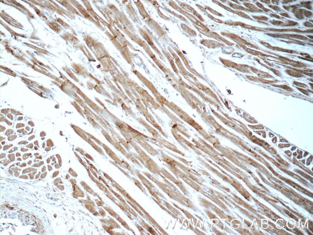 Immunohistochemistry (IHC) staining of human heart tissue using N-cadherin Polyclonal antibody (13769-1-AP)