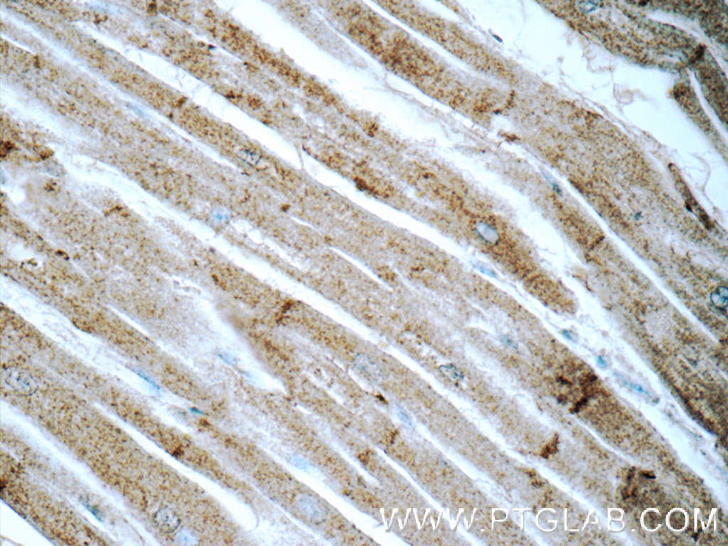 Immunohistochemistry (IHC) staining of human heart tissue using N-cadherin Polyclonal antibody (13769-1-AP)