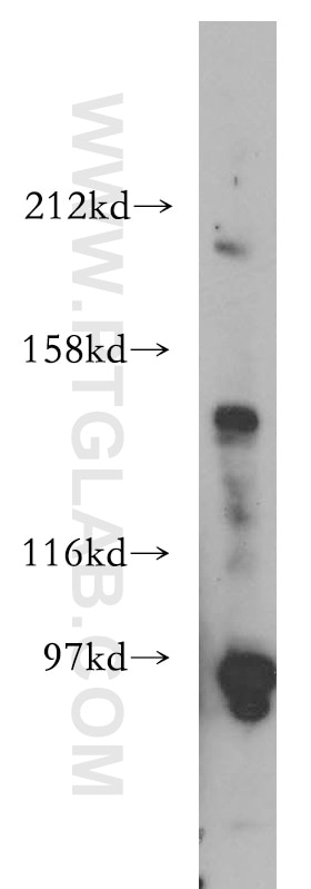 Western Blot (WB) analysis of HEK-293 cells using N-cadherin Polyclonal antibody (13769-1-AP)