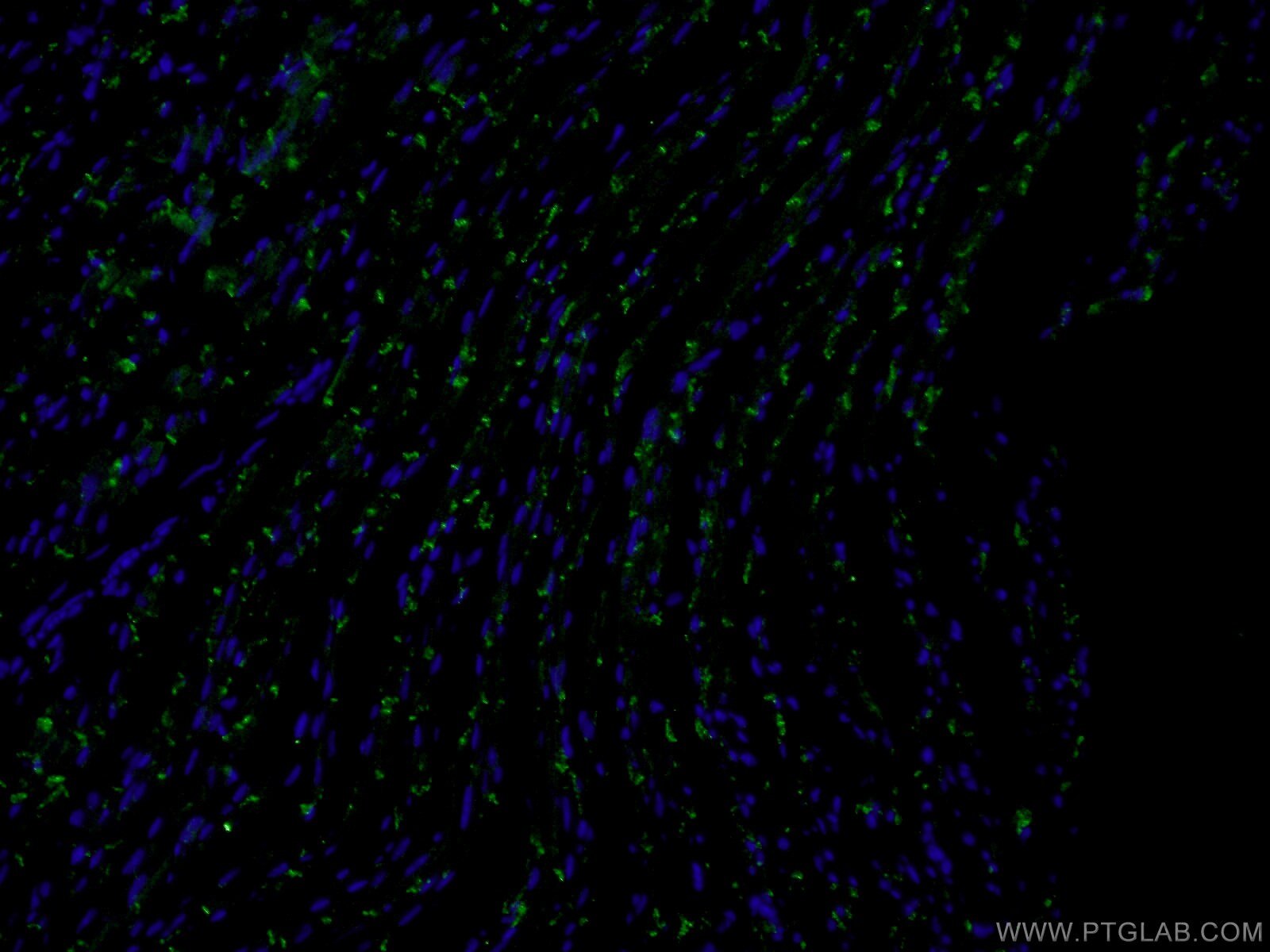 Immunofluorescence (IF) / fluorescent staining of mouse heart tissue using N-cadherin Polyclonal antibody (22018-1-AP)