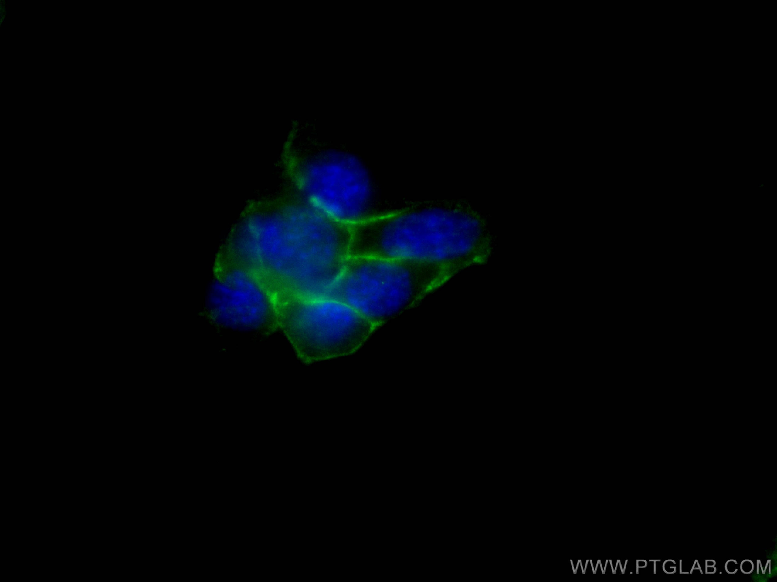 Immunofluorescence (IF) / fluorescent staining of C2C12 cells using N-cadherin Polyclonal antibody (22018-1-AP)