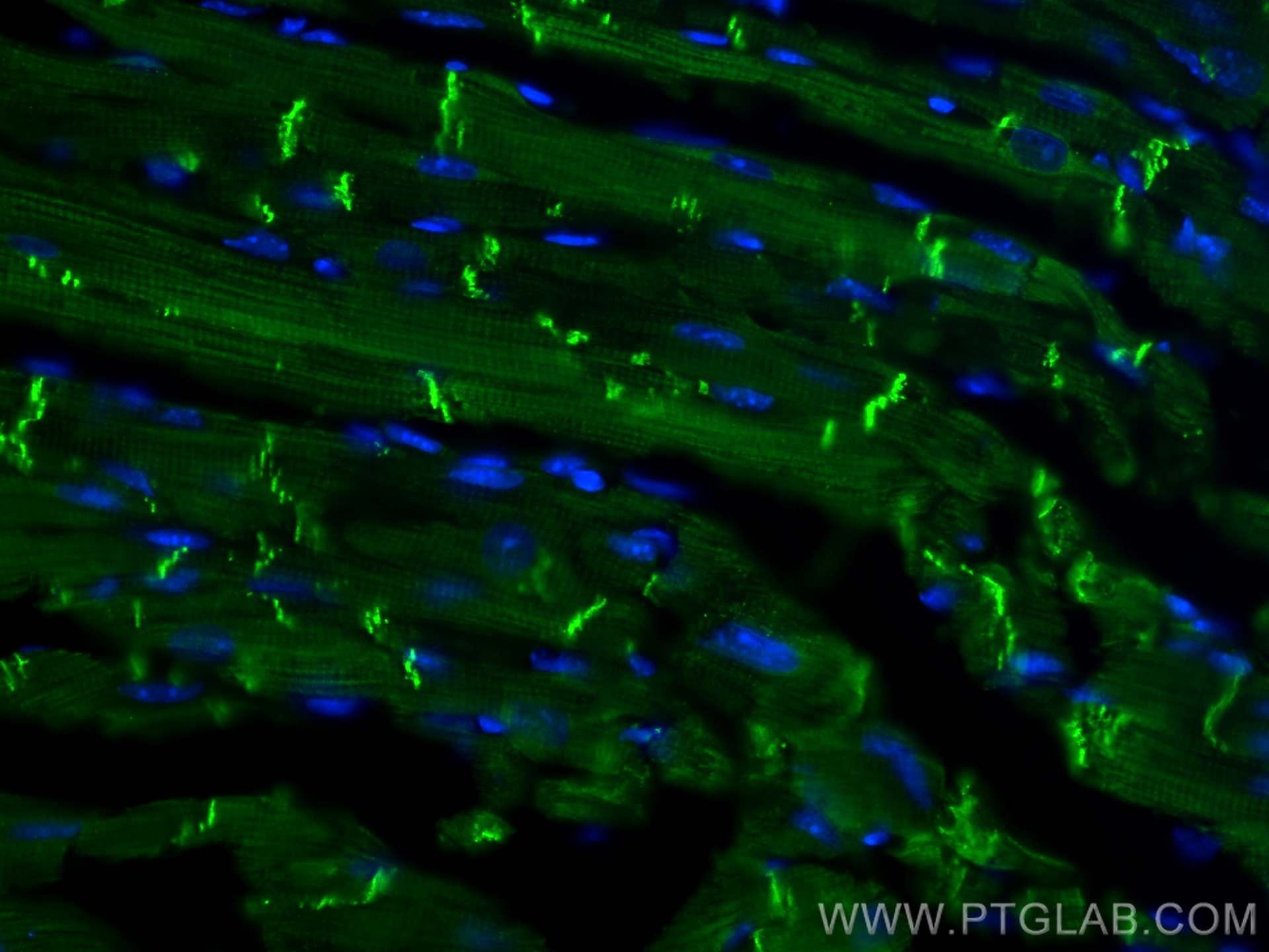 Immunofluorescence (IF) / fluorescent staining of mouse heart tissue using N-cadherin Polyclonal antibody (22018-1-AP)