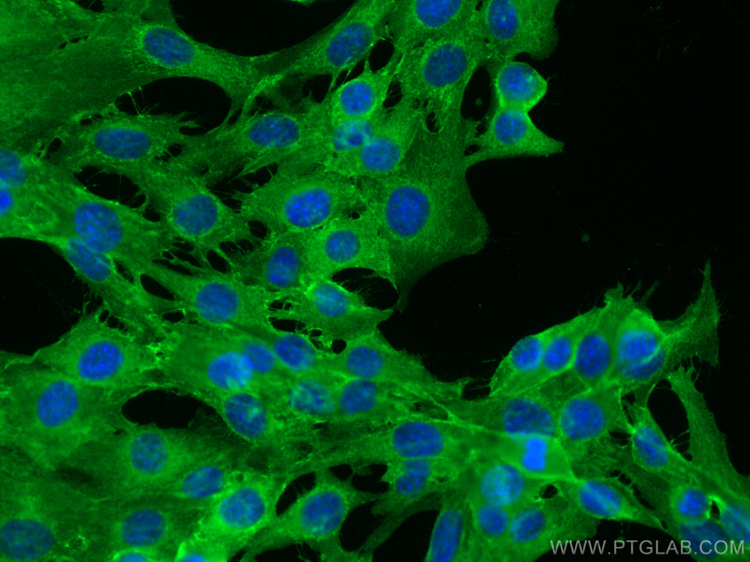 Immunofluorescence (IF) / fluorescent staining of C2C12 cells using N-cadherin Polyclonal antibody (22018-1-AP)
