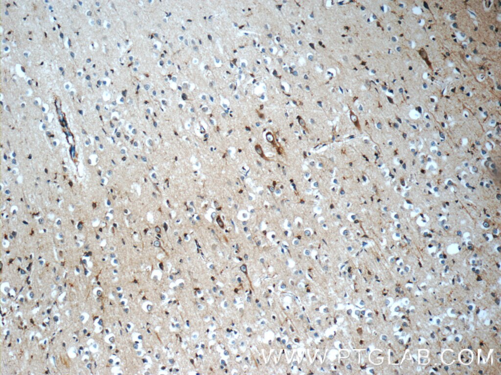 N-cadherin Polyclonal antibody