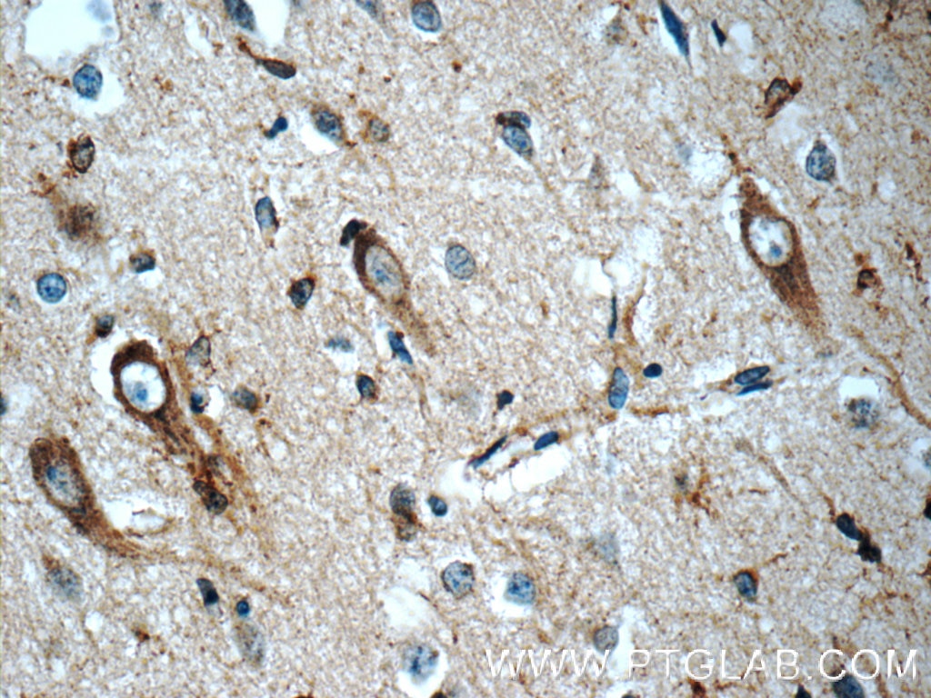 N-cadherin Polyclonal antibody