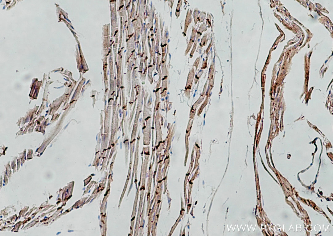 Immunohistochemistry (IHC) staining of mouse heart tissue using N-cadherin Polyclonal antibody (22018-1-AP)
