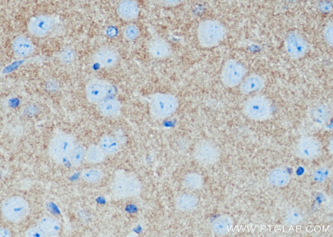 IHC staining of mouse brain using 22018-1-AP