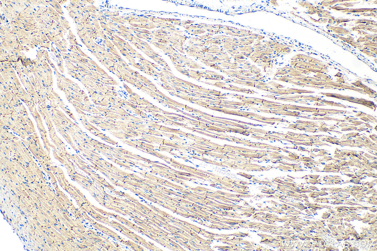 IHC staining of mouse heart using 22018-1-AP