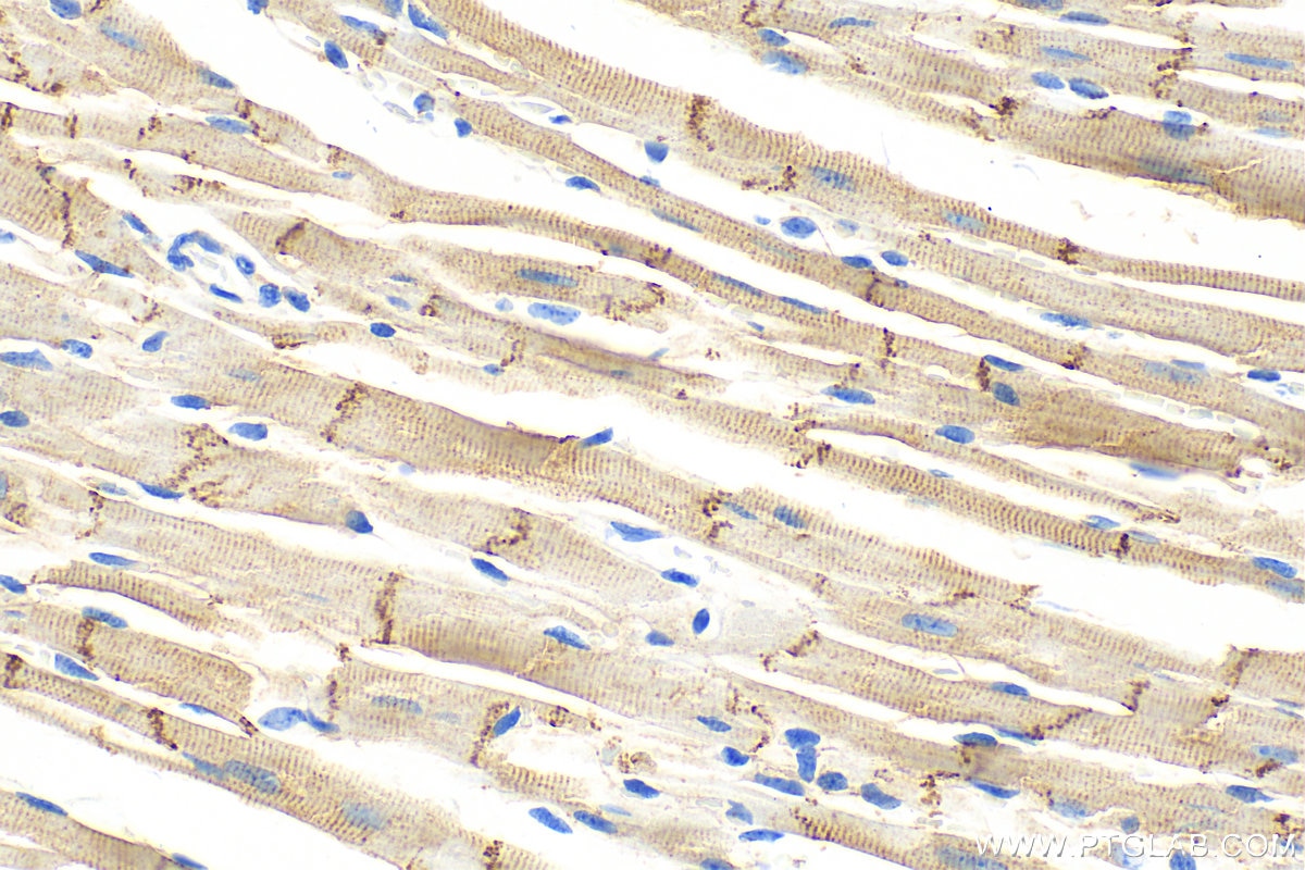 Immunohistochemistry (IHC) staining of mouse heart tissue using N-cadherin Polyclonal antibody (22018-1-AP)