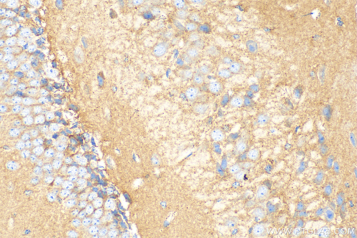 Immunohistochemistry (IHC) staining of mouse brain tissue using N-cadherin Polyclonal antibody (22018-1-AP)