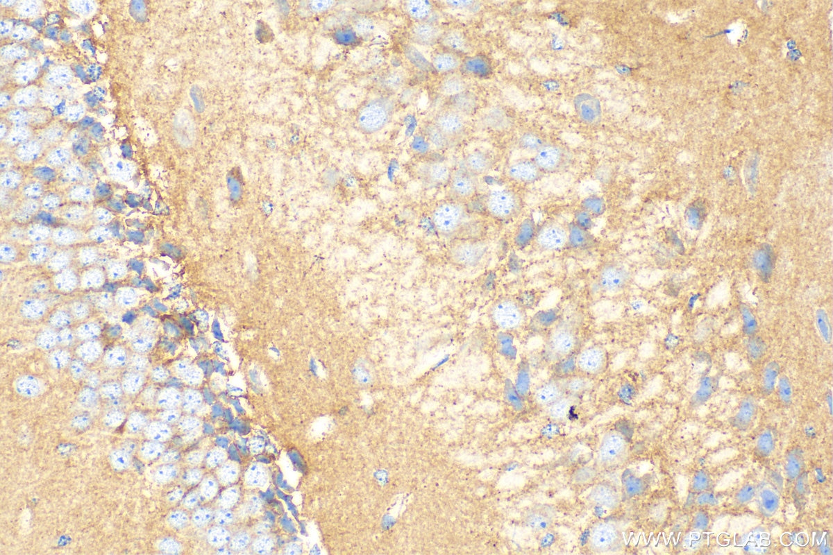 IHC staining of mouse brain using 22018-1-AP