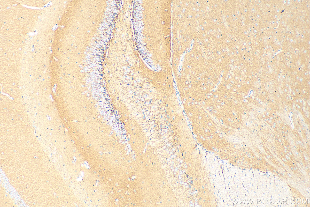 Immunohistochemistry (IHC) staining of mouse brain tissue using N-cadherin Polyclonal antibody (22018-1-AP)