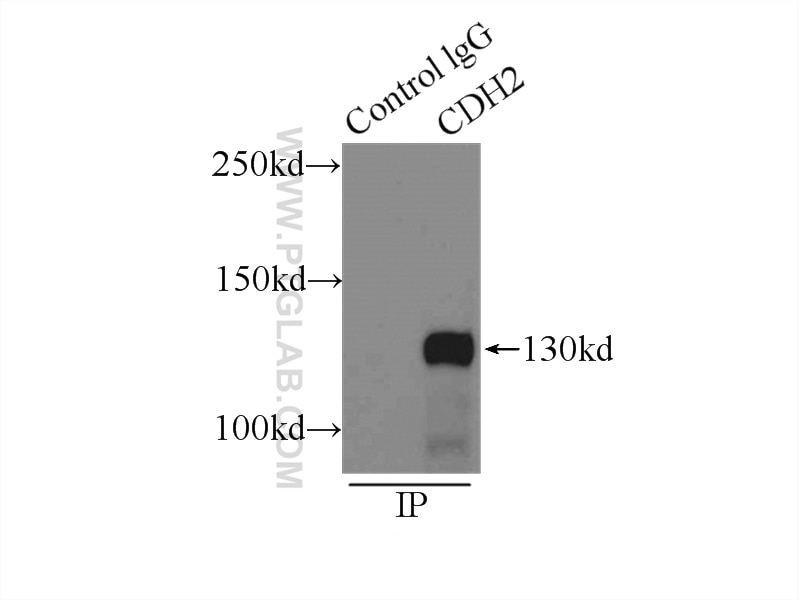 Immunoprecipitation (IP) experiment of mouse brain tissue using N-cadherin Polyclonal antibody (22018-1-AP)