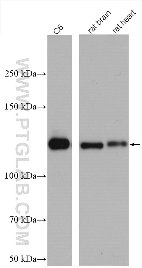 Western Blot (WB) analysis of various lysates using N-cadherin Polyclonal antibody (22018-1-AP)