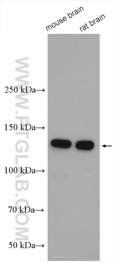 Western Blot (WB) analysis of various lysates using N-cadherin Polyclonal antibody (22018-1-AP)