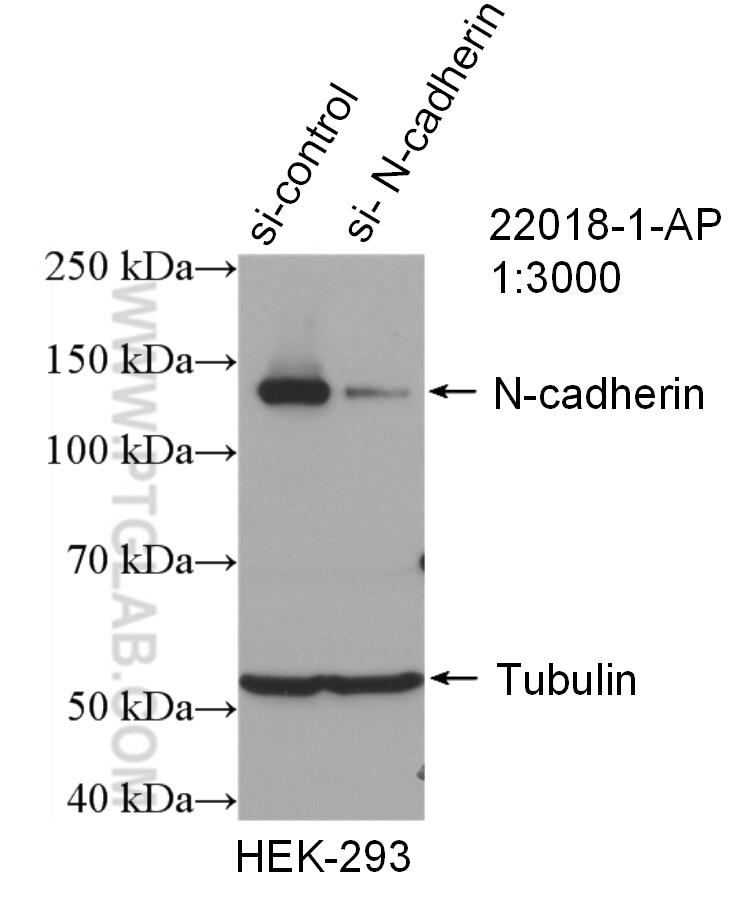 Western Blot (WB) analysis of HEK-293 cells using N-cadherin Polyclonal antibody (22018-1-AP)