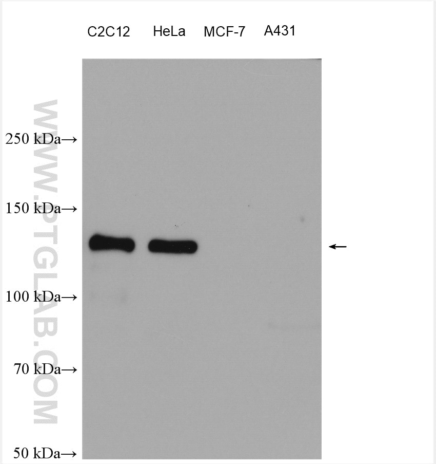 Western Blot (WB) analysis of various lysates using N-cadherin Polyclonal antibody (22018-1-AP)