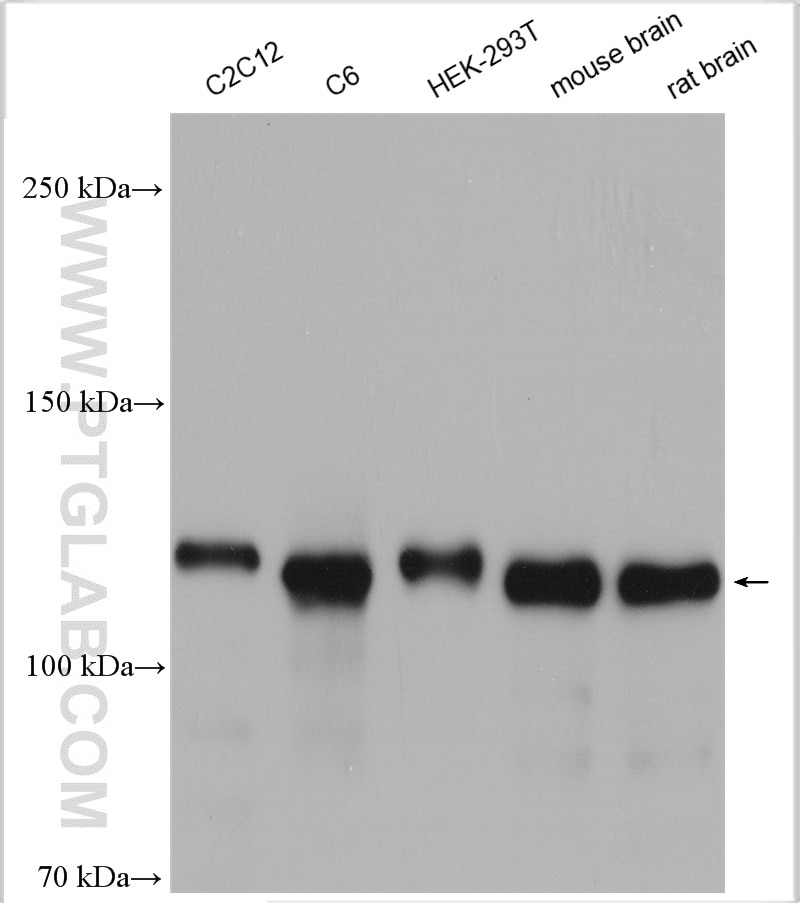 Western Blot (WB) analysis of various lysates using N-cadherin Polyclonal antibody (22018-1-AP)