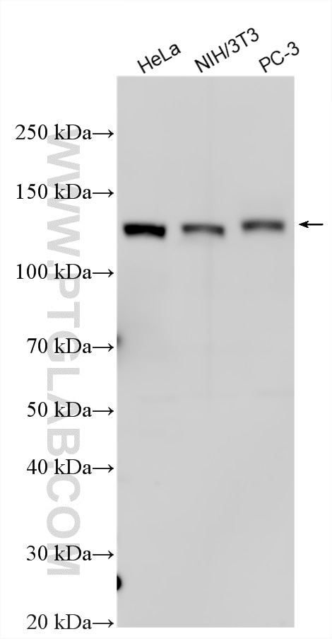 Western Blot (WB) analysis of various lysates using N-cadherin Polyclonal antibody (22018-1-AP)