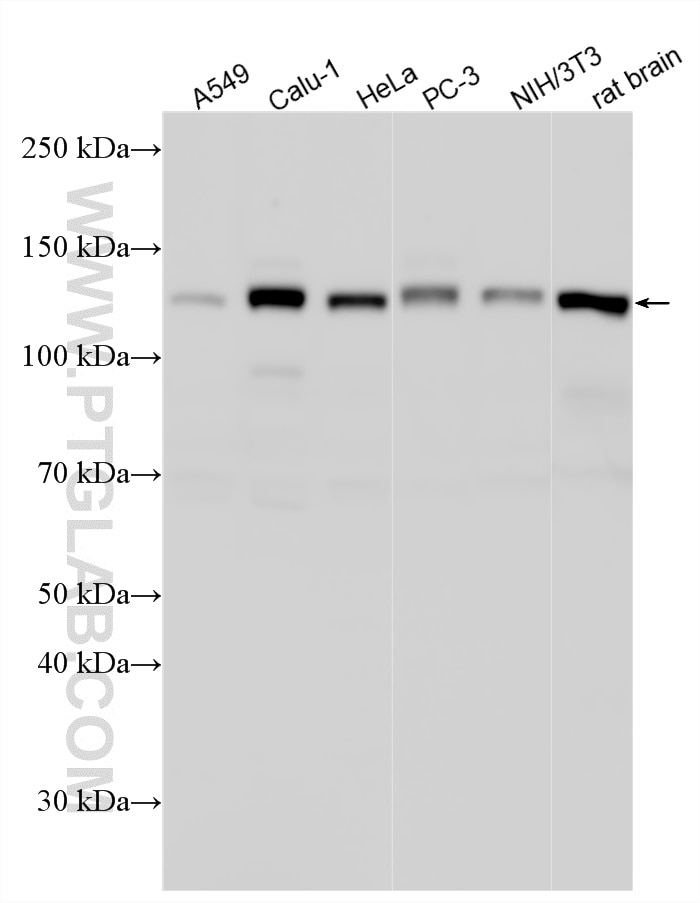 Western Blot (WB) analysis of various lysates using N-cadherin Polyclonal antibody (22018-1-AP)
