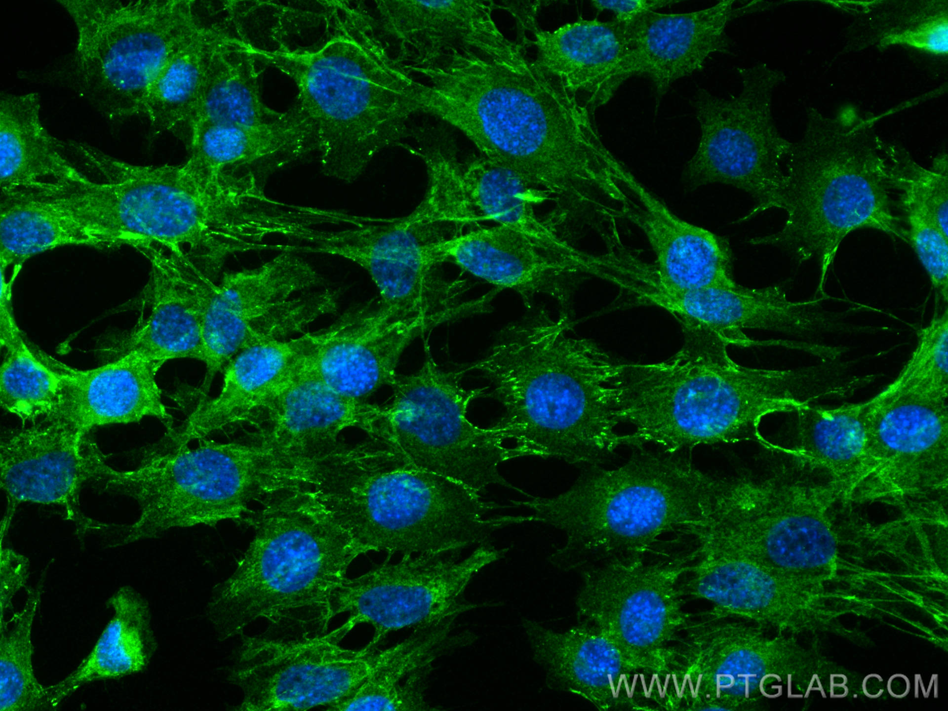 Immunofluorescence (IF) / fluorescent staining of C2C12 cells using N-cadherin Polyclonal antibody (30803-1-AP)