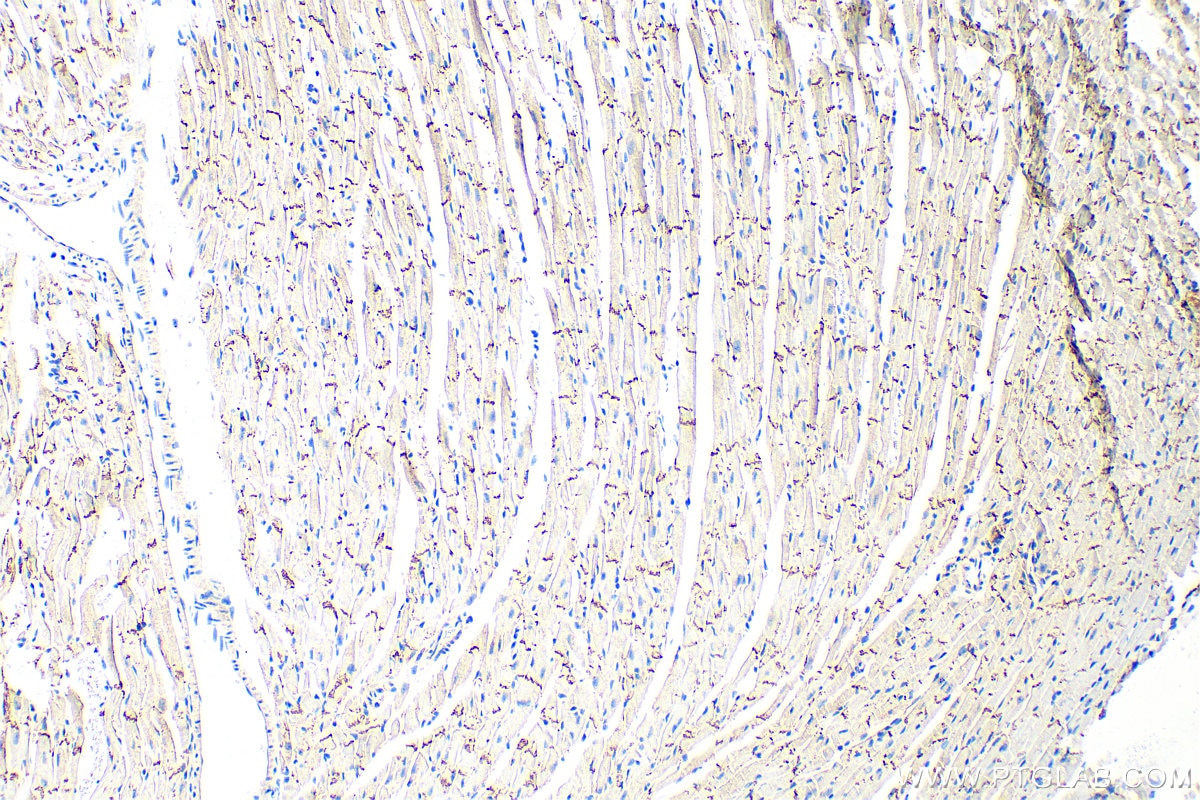 Immunohistochemistry (IHC) staining of mouse heart tissue using N-cadherin Polyclonal antibody (30803-1-AP)