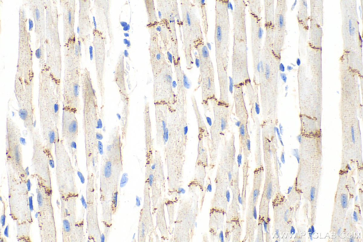 Immunohistochemistry (IHC) staining of mouse heart tissue using N-cadherin Polyclonal antibody (30803-1-AP)