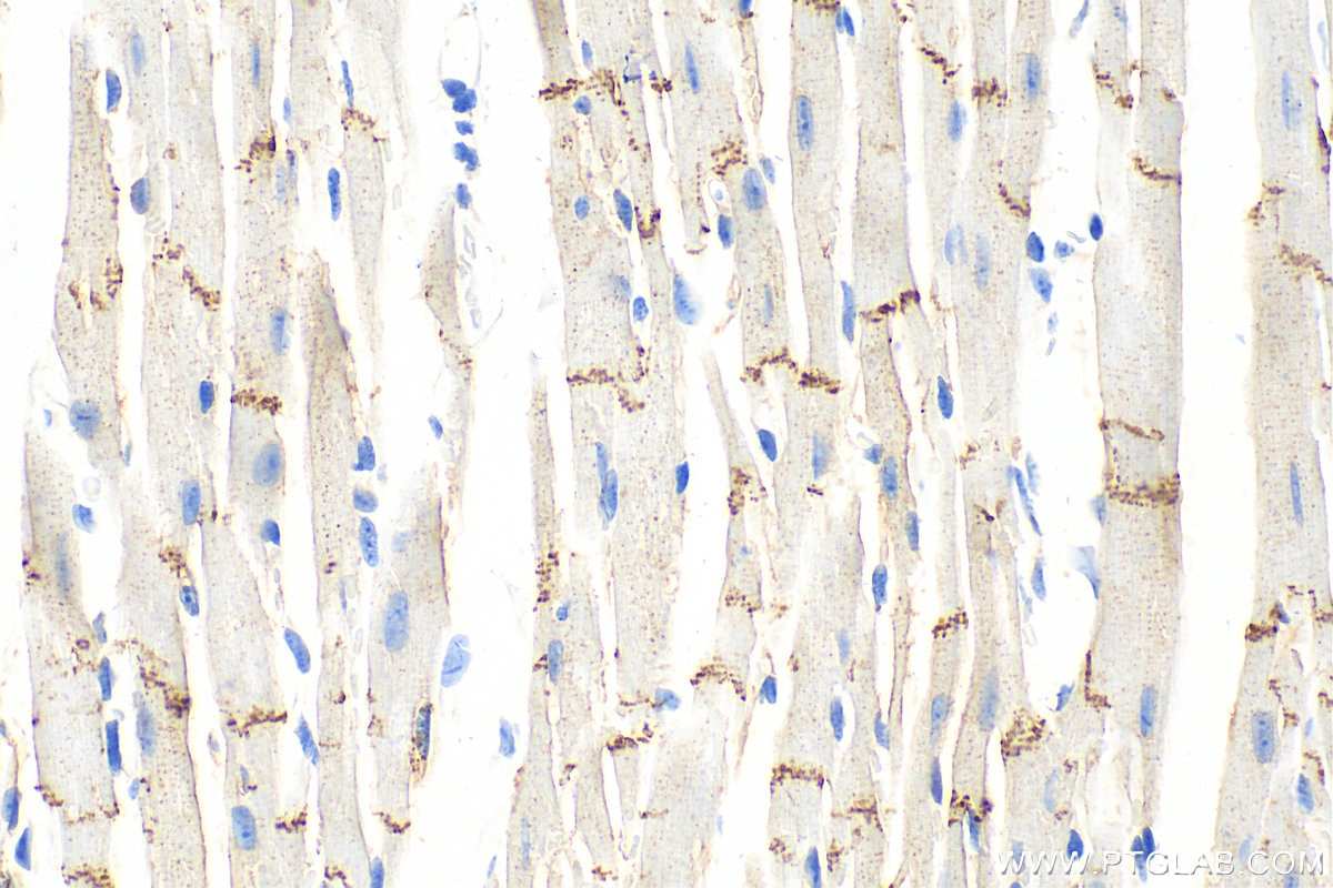 N-cadherin