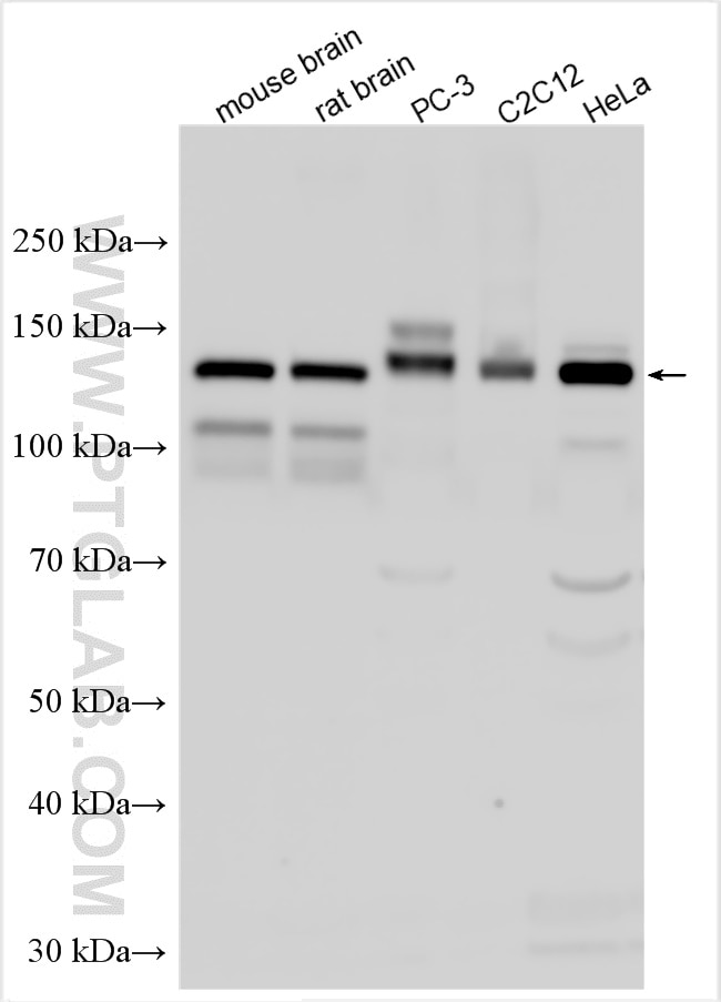 Western Blot (WB) analysis of various lysates using N-cadherin Polyclonal antibody (30803-1-AP)