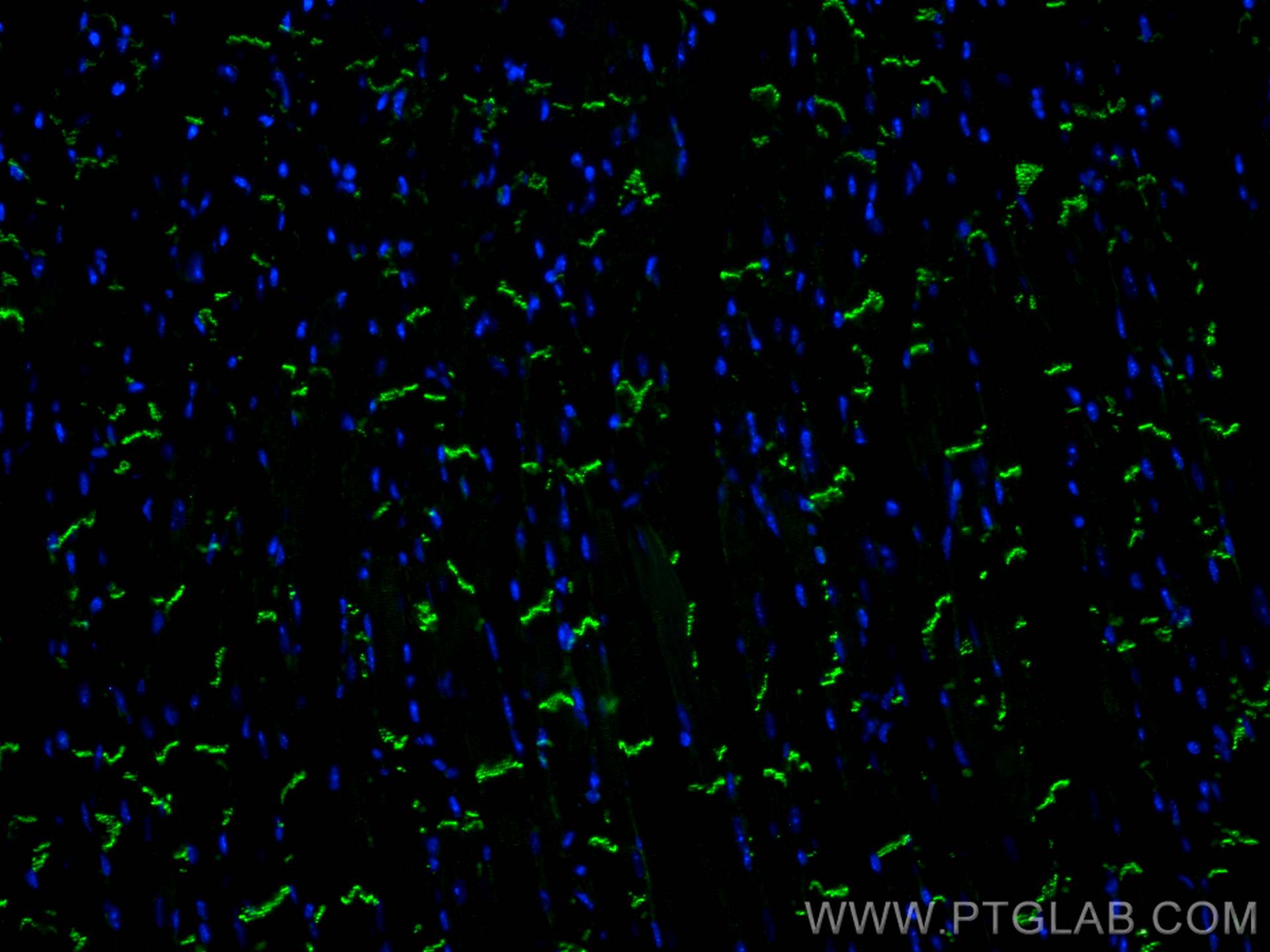 Immunofluorescence (IF) / fluorescent staining of mouse heart tissue using N-cadherin Monoclonal antibody (66219-1-Ig)