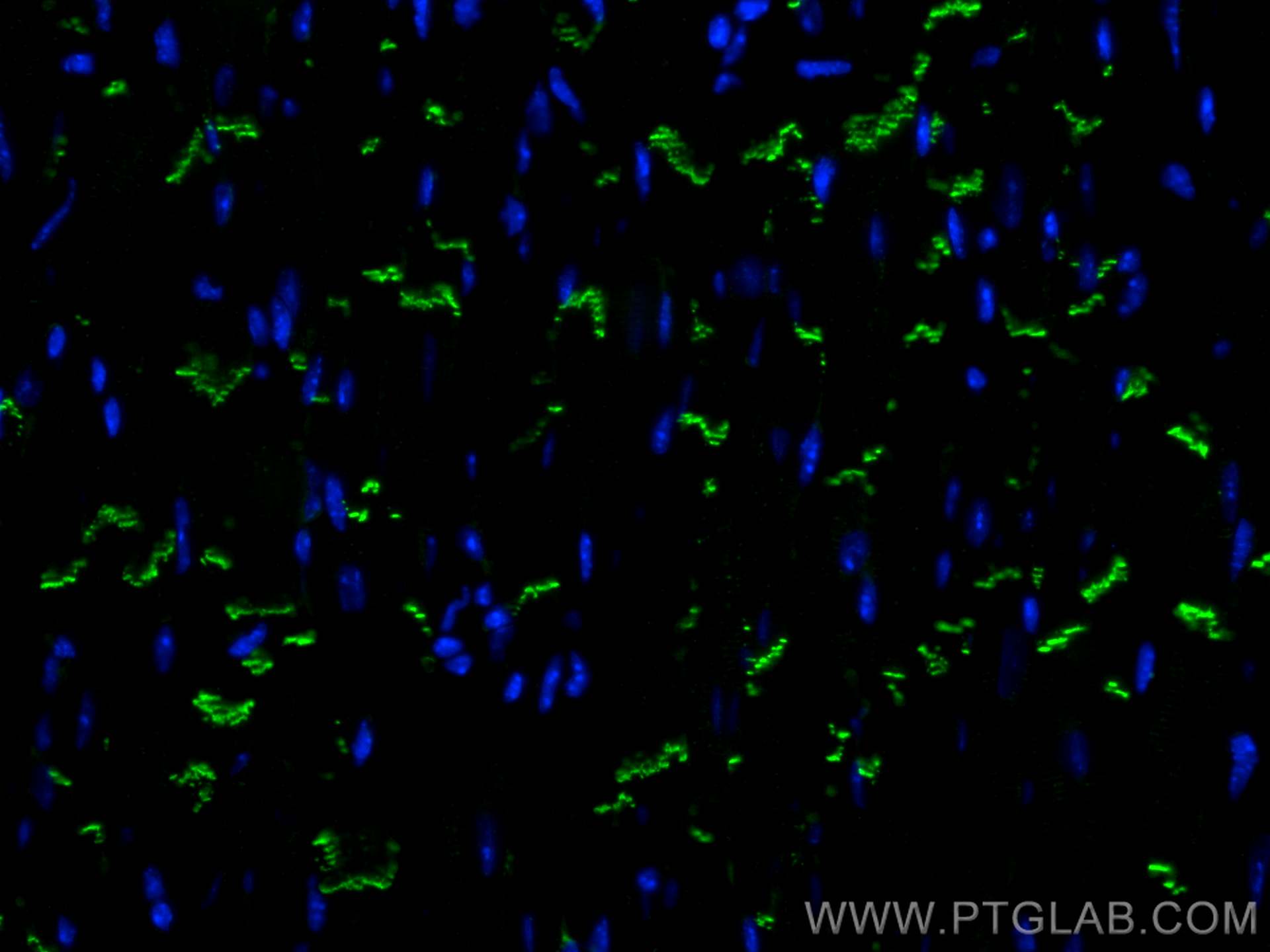 Immunofluorescence (IF) / fluorescent staining of mouse heart tissue using N-cadherin Monoclonal antibody (66219-1-Ig)