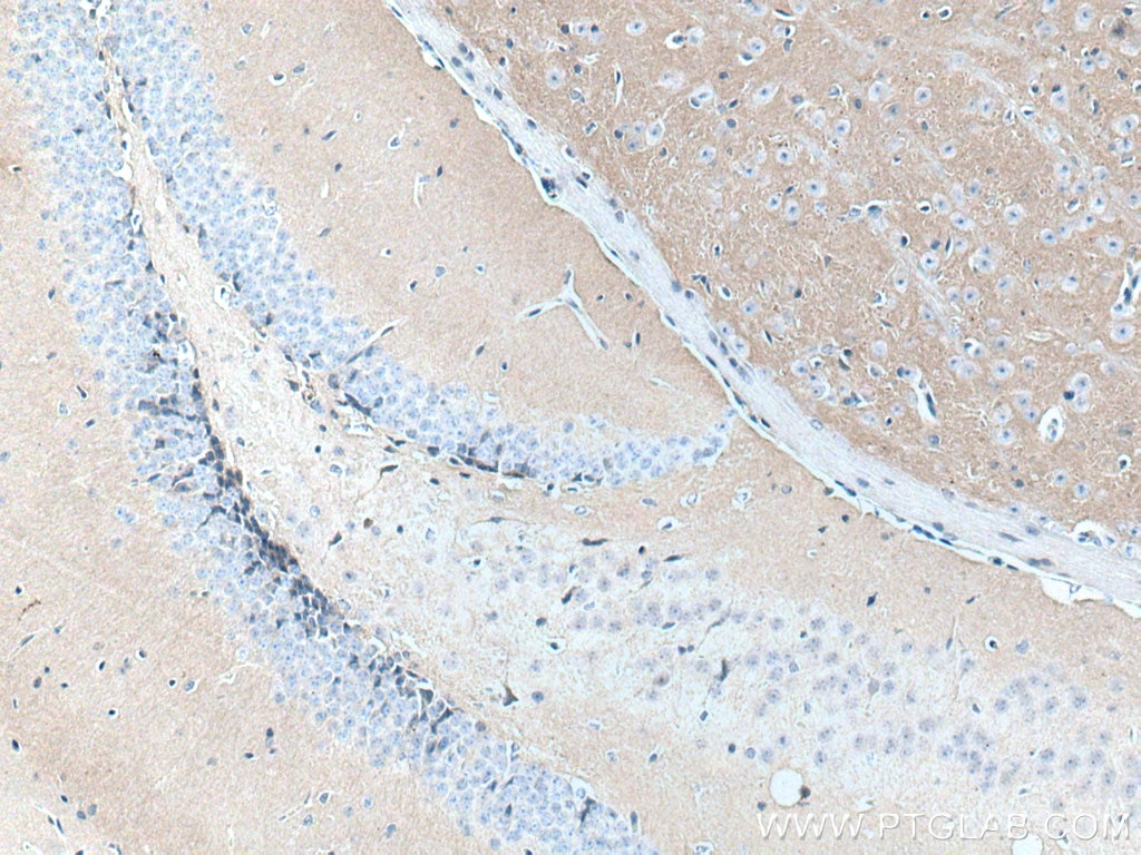 Immunohistochemistry (IHC) staining of mouse brain tissue using N-cadherin Monoclonal antibody (66219-1-Ig)