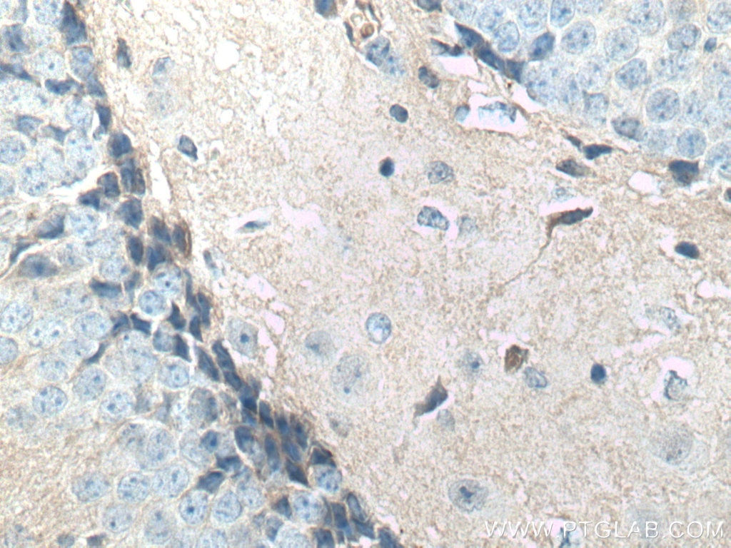 Immunohistochemistry (IHC) staining of mouse brain tissue using N-cadherin Monoclonal antibody (66219-1-Ig)