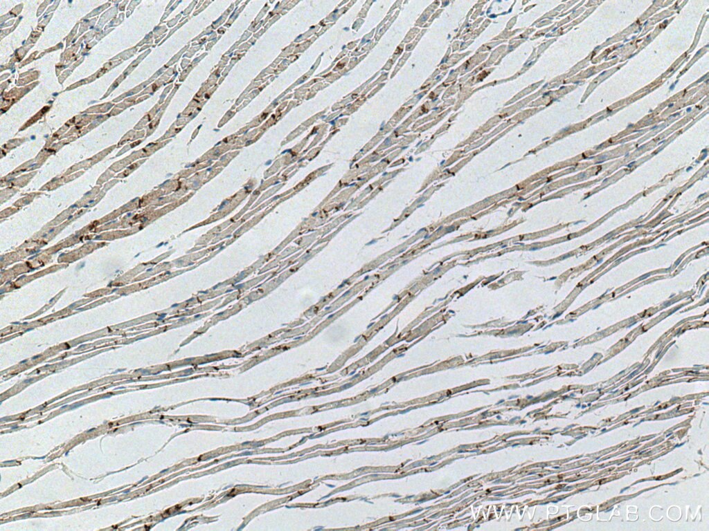 N-cadherin