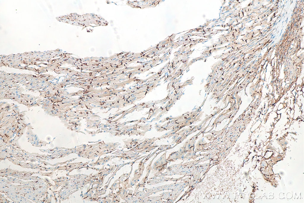 Immunohistochemistry (IHC) staining of mouse heart tissue using N-cadherin Monoclonal antibody (66219-1-Ig)