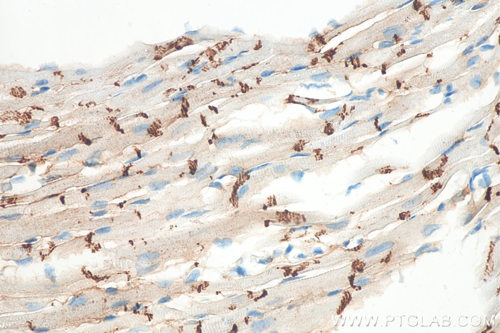 Immunohistochemistry (IHC) staining of mouse heart tissue using N-cadherin Monoclonal antibody (66219-1-Ig)