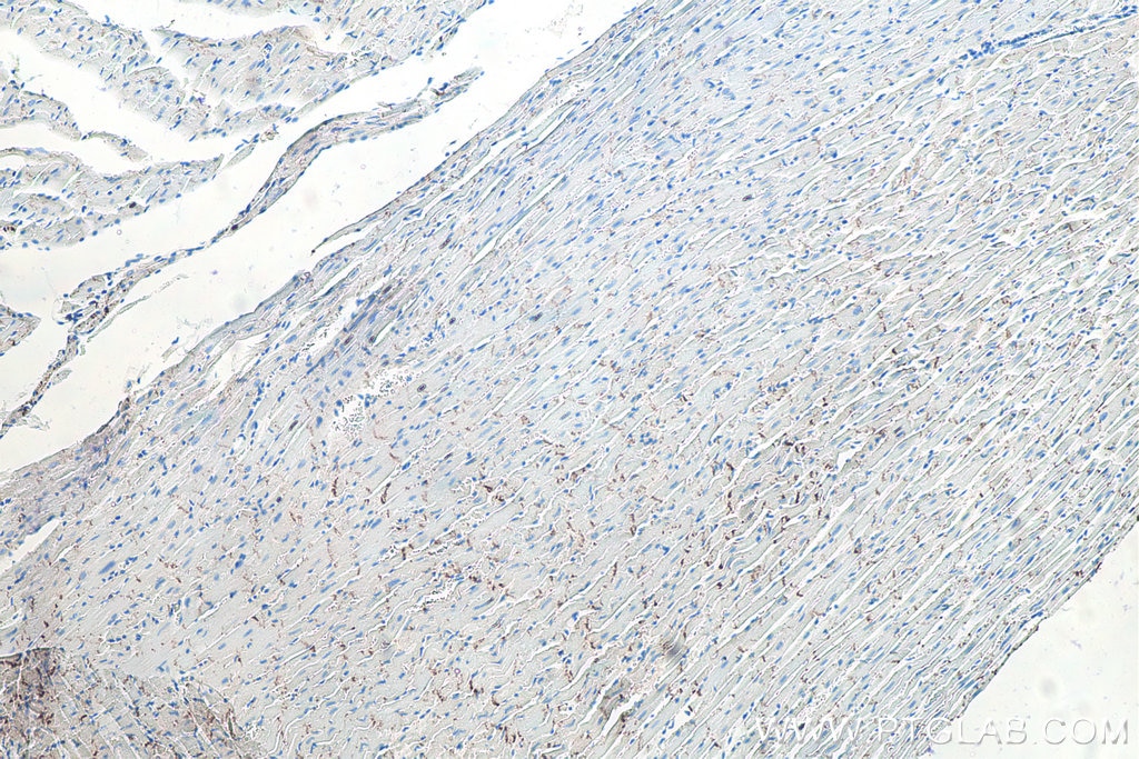 Immunohistochemistry (IHC) staining of rat heart tissue using N-cadherin Monoclonal antibody (66219-1-Ig)